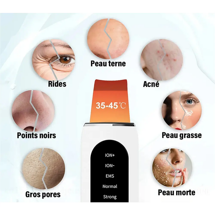 STELLAR - Exfoliant Lifting EMS  5 fonctions  - Soin à ultrasons & photons-3